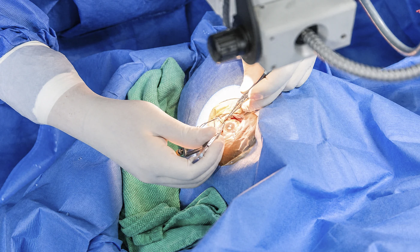 Cirugía de Glaucoma e Implantes de Drenaje