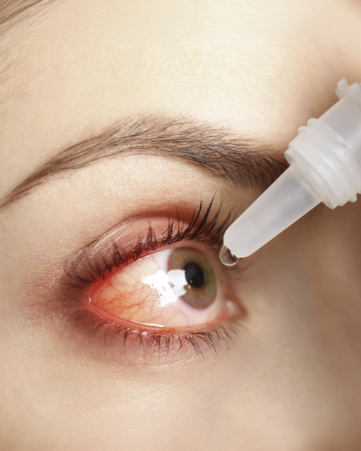 Tratamiento de ojo seco y Spa de Ojo Seco en Centro Láser, Santo Domingo